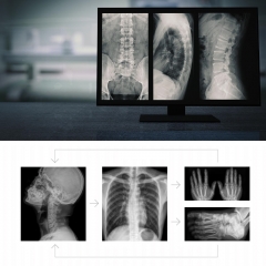 MY-D048A DR Deckenmontiertes digitales Radiographiesystem für Krankenhaus